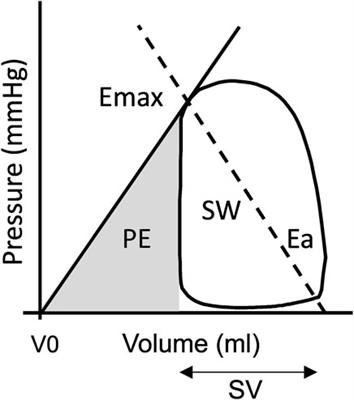 Patients with volume-loaded right ventricle - quantification of left ventricular hemodynamic response to intervention measured by noninvasive pressure-volume loops